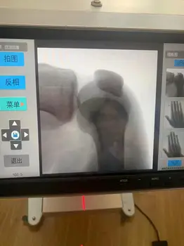 Medicinos fluoroscopio nešiojamų x-ray veterinaria rentgeno sistemą, boej fluoroskopijos x ray mašina